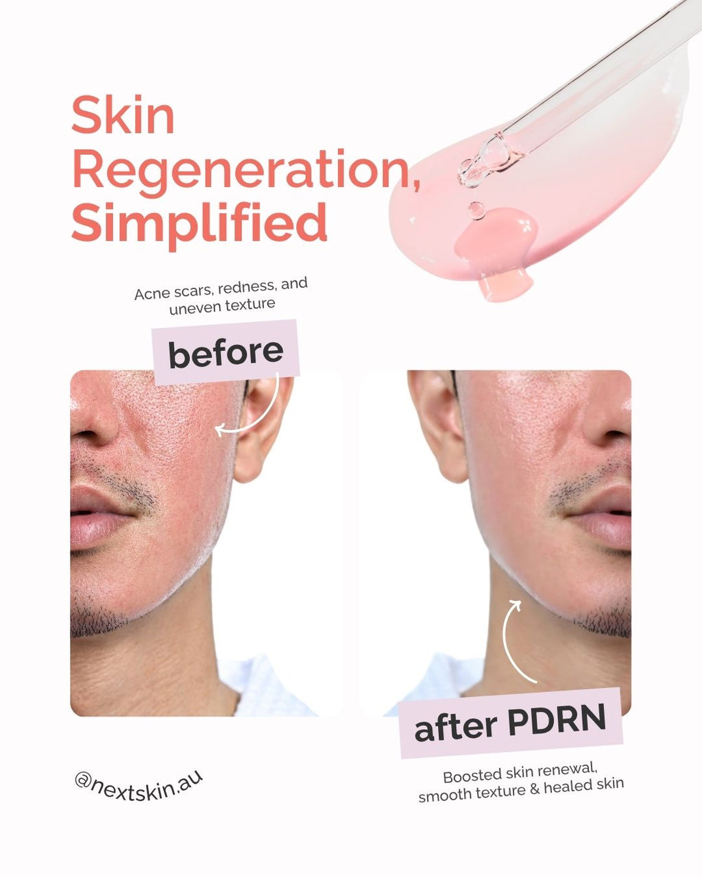 Skin Reset Kit | Serum Duo